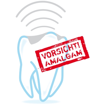 Amalgam Zahn © Oliver Muth - fotolia.com Vorsicht Amalgam